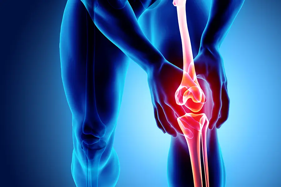X-ray of a knee joint with inflamed areas highlighted for GAE evaluation