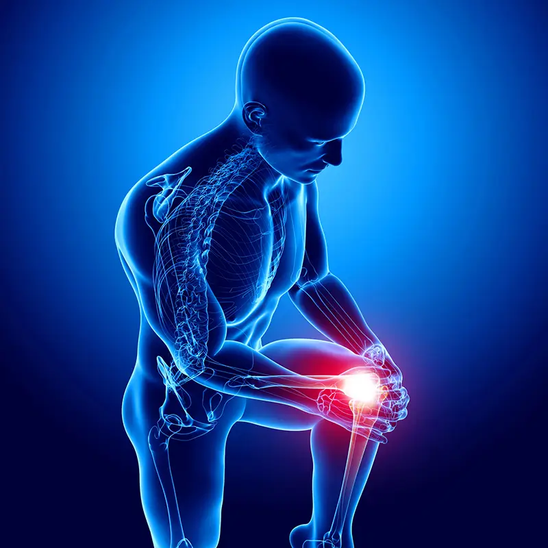 3D illustration of knee pain related to genicular artery issues treated with GAE